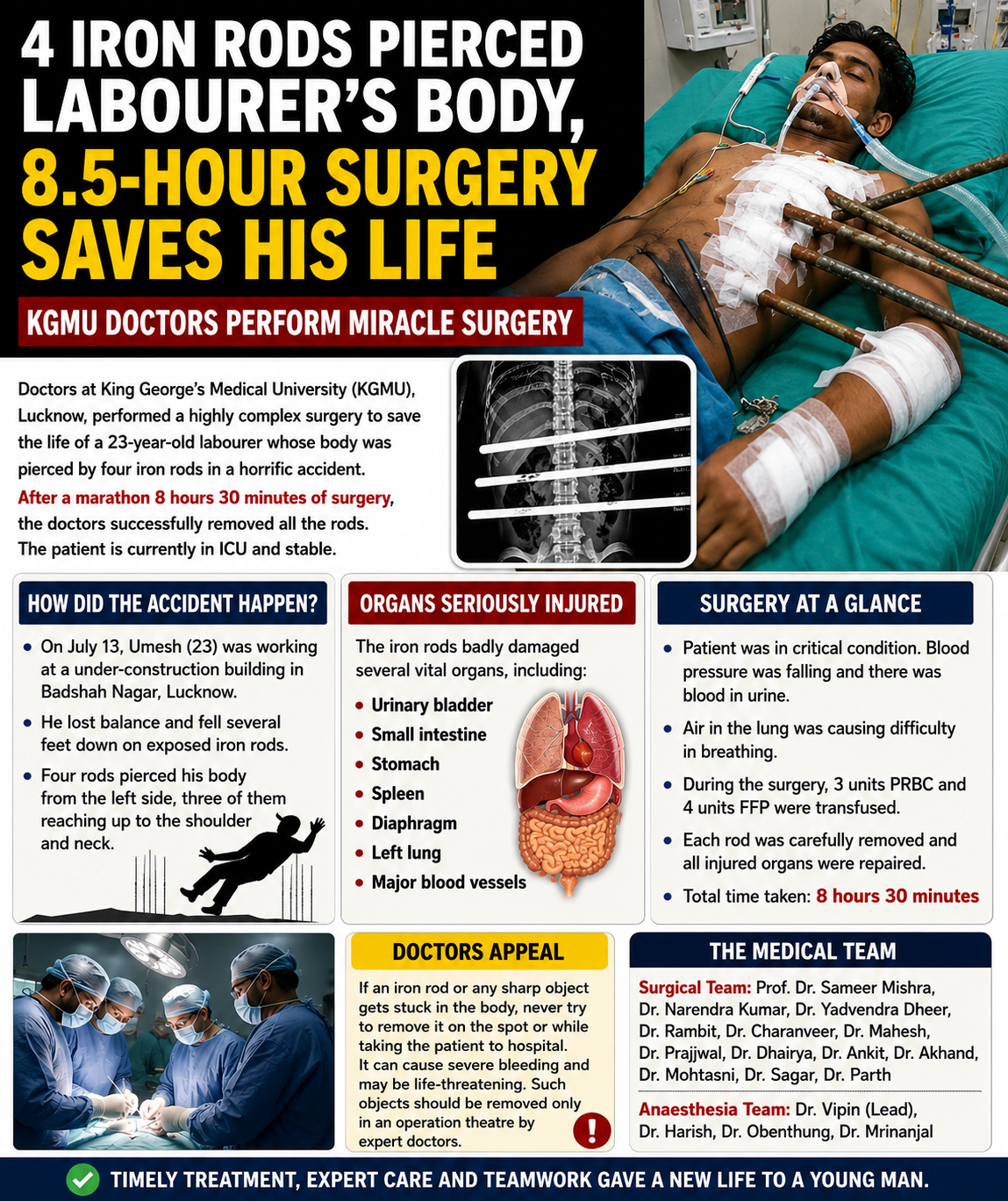 Four Iron Rods Pierced Labourer’s Body, 8.5-Hour Surgery Saves His Life at KGMU