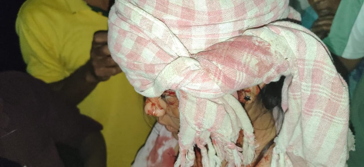 SIR Work Ends in Tragedy in Koderma, Woman Killed in Road Accident